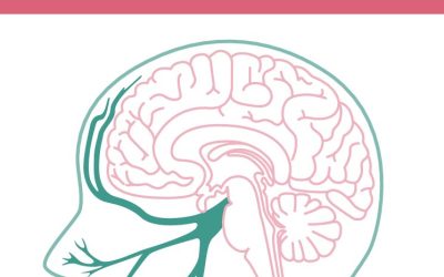 Actualités 6 Brochure : C’est quoi la migraine ?