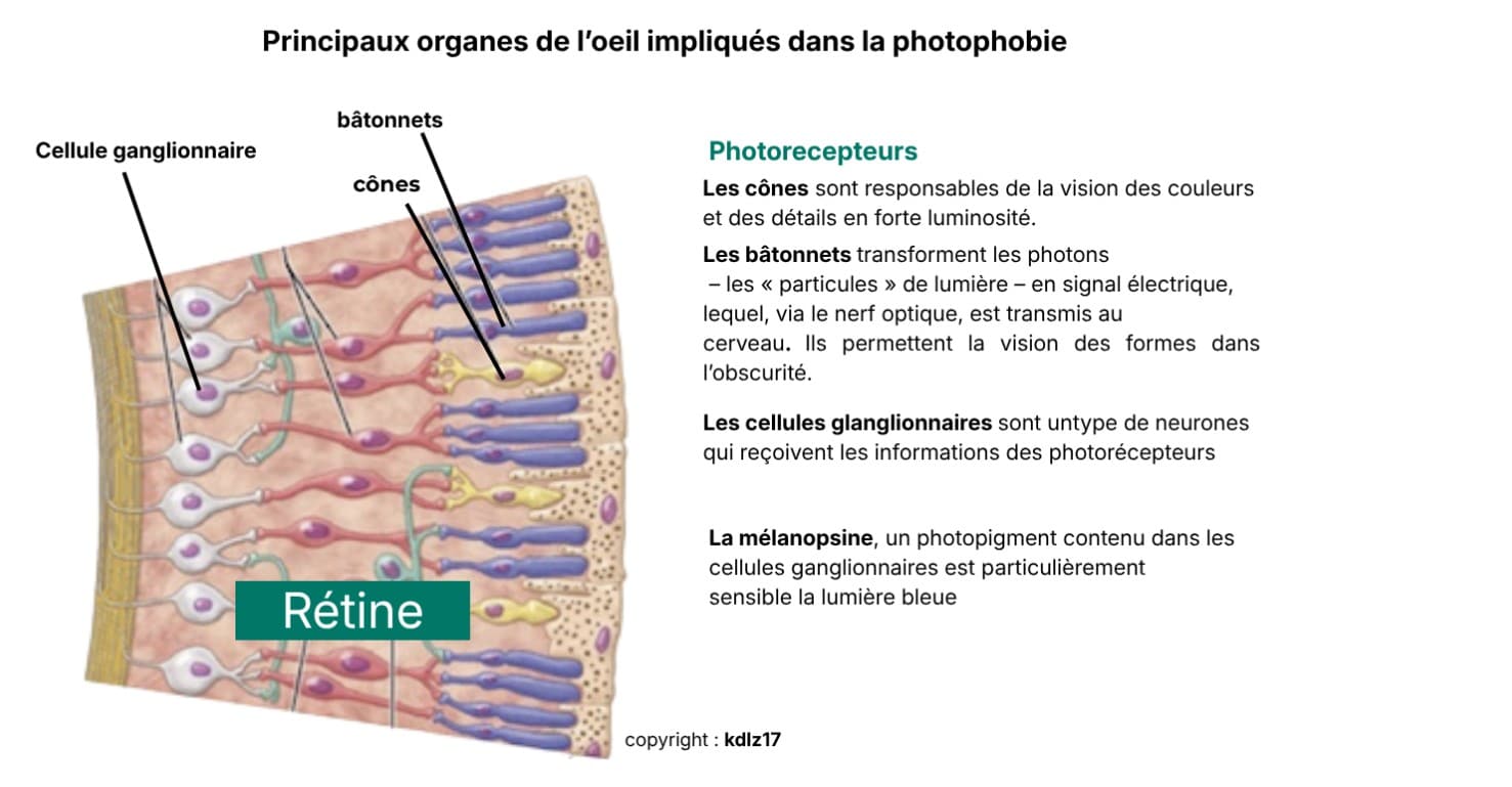 photo-oeil-photophobie-migraine photo oeil photophobie migraine